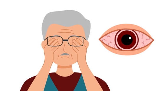 مضرات مالش چشم و دلیل پرهیز از آن 