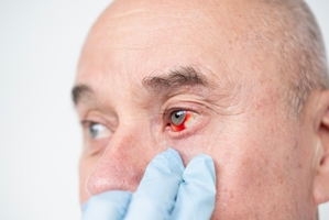 راهنما برای اقدامات فوری که بینایی شما را نجات می‌دهد